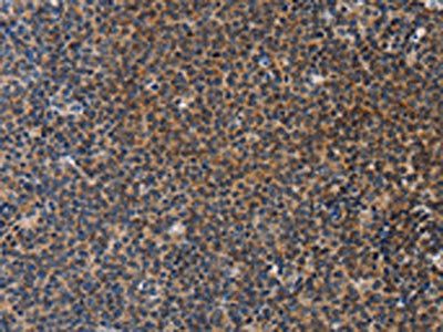 STRADB Antibody