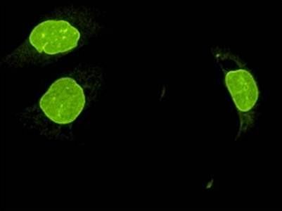SUN2 Antibody