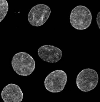 SUN2 Antibody