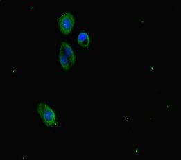 SUZ12 Antibody