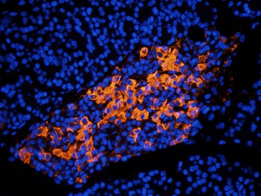 Syndecan 2 Rabbit Polyclonal Antibody