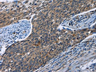 SYT3 Antibody