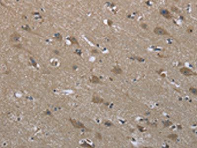 SYT3 Antibody