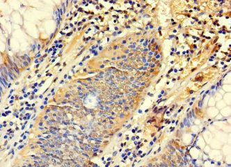 SYTL3 Antibody