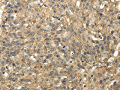 TACSTD2 Antibody