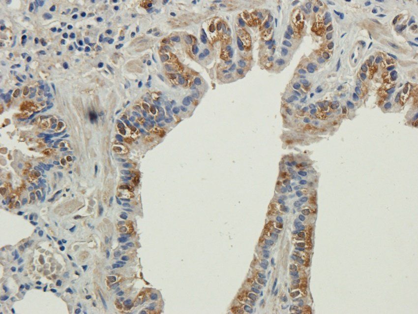 TAL1 Rabbit Polyclonal Antibody