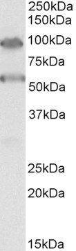 TBC1D9 Antibody
