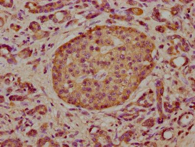 TCAF2 Antibody