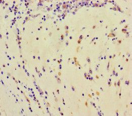 TDRD3 Antibody