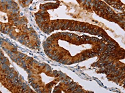TFF3 Antibody