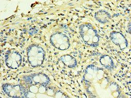 TFG Antibody