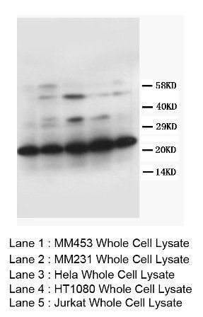 TFPI2 Rabbit Polyclonal Antibody