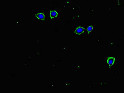 TGFBR2 Antibody