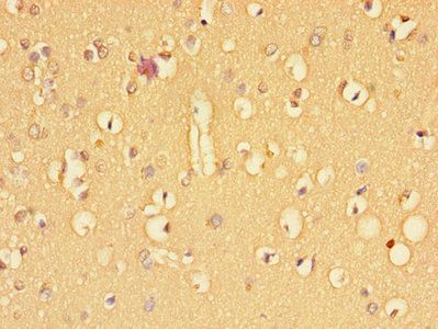 TGFBR2 Antibody