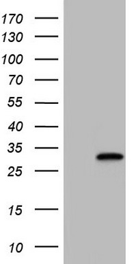 TGIF1 Antibody