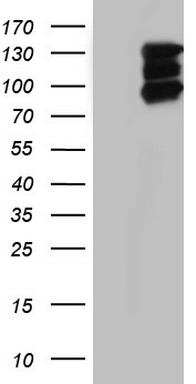 TGIF1 Antibody