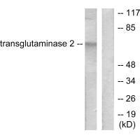 TGM2 Antibody