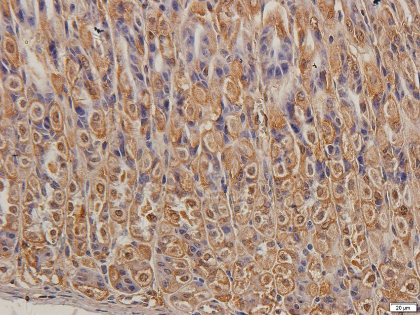 TIMP1 Rabbit Polyclonal Antibody