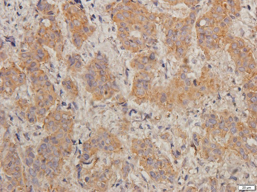 TIMP1 Rabbit Polyclonal Antibody