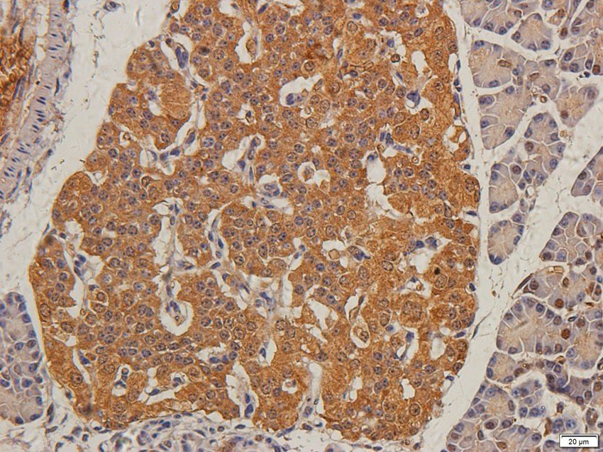 TIMP1 Rabbit Polyclonal Antibody