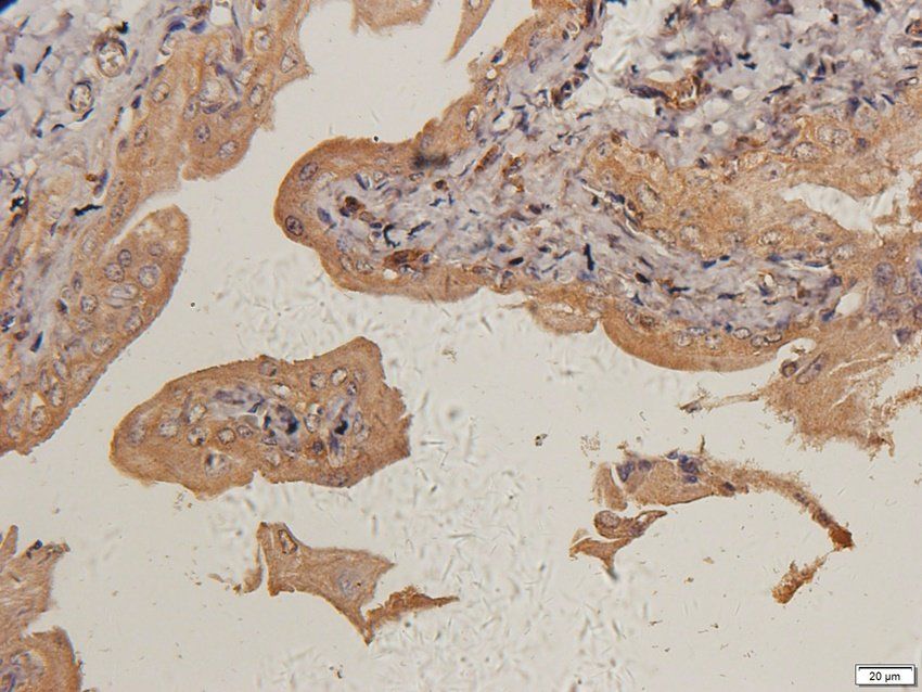 TIMP1 Rabbit Polyclonal Antibody