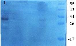 TIMP1 Rabbit Polyclonal Antibody