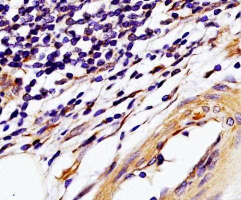 TIMP1 Rabbit Polyclonal Antibody