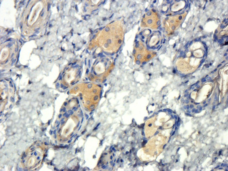 TIMP1 Rabbit Polyclonal Antibody