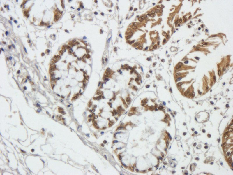 TIMP1 Rabbit Polyclonal Antibody