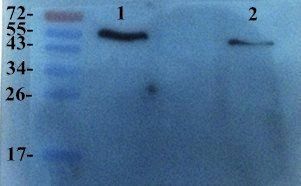 TIMP1 Rabbit Polyclonal Antibody