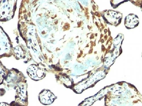TIMP3 Antibody