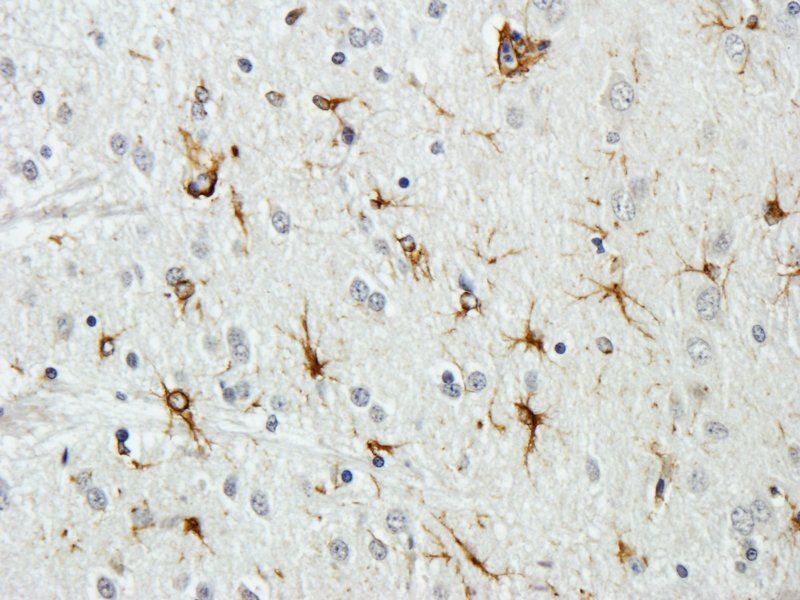 Tissue Factor Rabbit Polyclonal Antibody