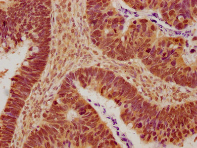 TJP2 Antibody