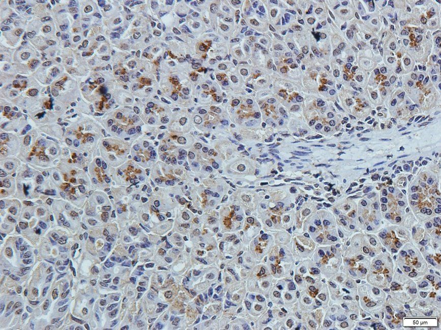 TKTL1 Rabbit Polyclonal Antibody