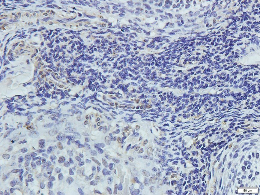 TKTL1 Rabbit Polyclonal Antibody