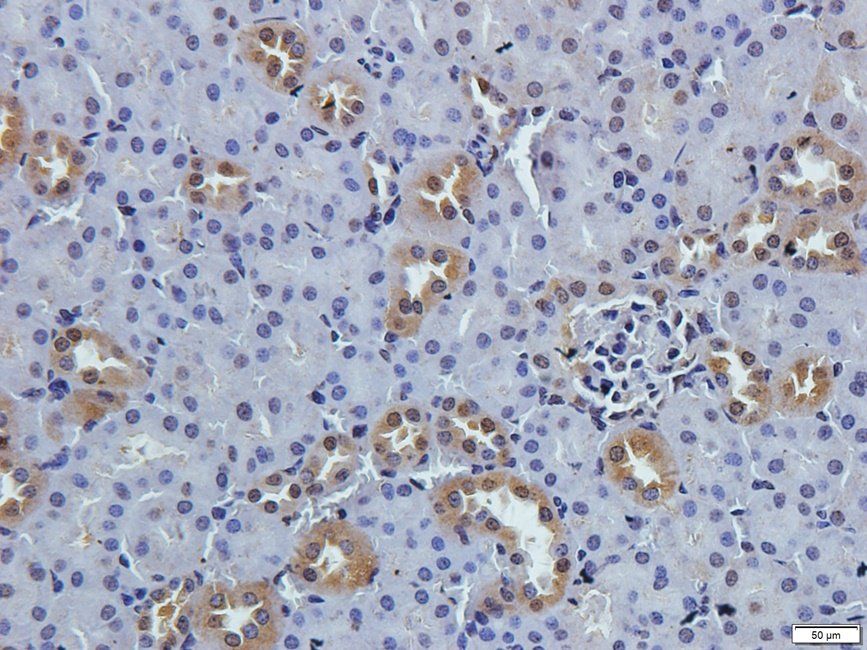 TKTL1 Rabbit Polyclonal Antibody