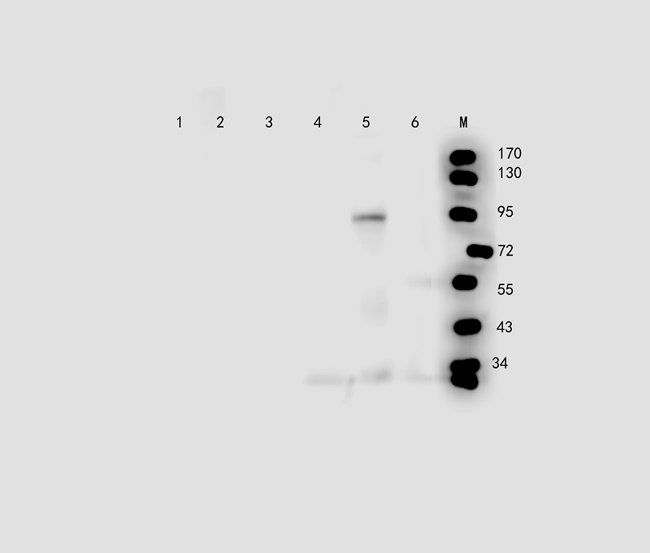 TKTL1 Rabbit Polyclonal Antibody