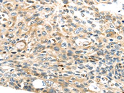 TMPRSS4 Antibody