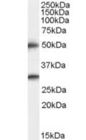 Spinesin/TMPRSS5 Antibody