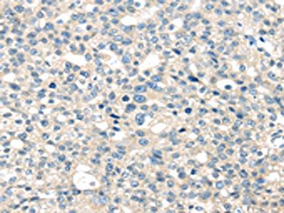 TNFAIP8 Antibody