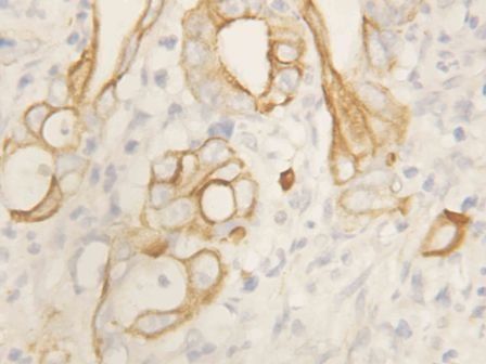 TNF Receptor II/TNFRSF1B Rabbit Polyclonal Antibody