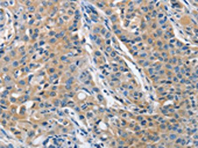 TNFSF13 Antibody