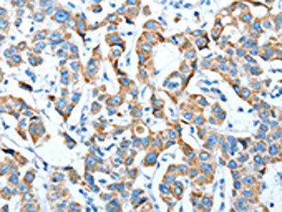 TNNI3 Antibody