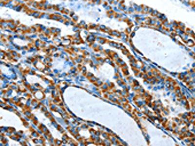TNNI3 Antibody