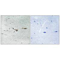 TOB1 Antibody