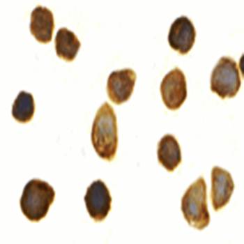 TOLLIP Antibody