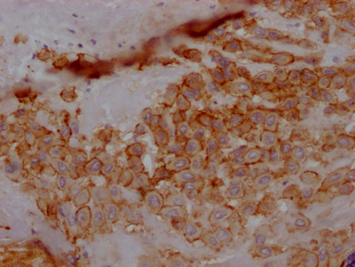 TPBG Antibody