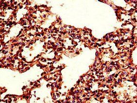 TPI1 Antibody