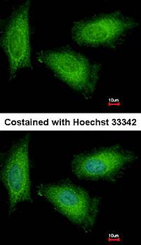 TPI1 antibody