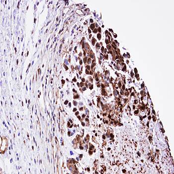 TPI1 antibody
